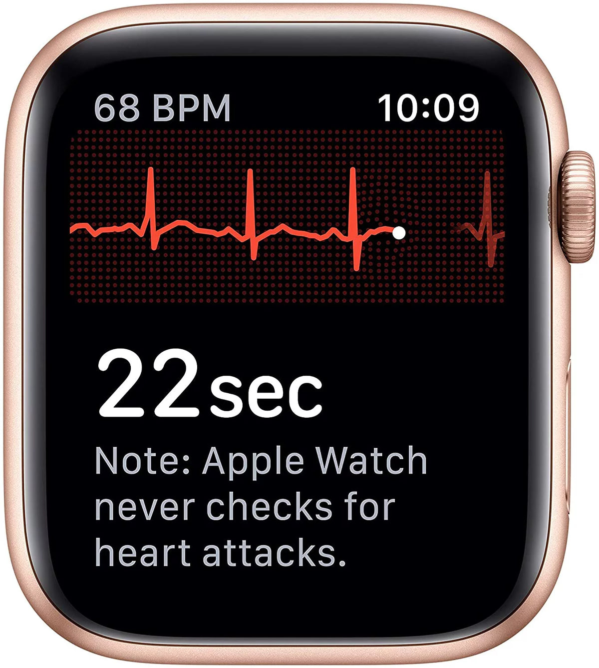 Gold 40MM Apple Watch Series 5 O2436